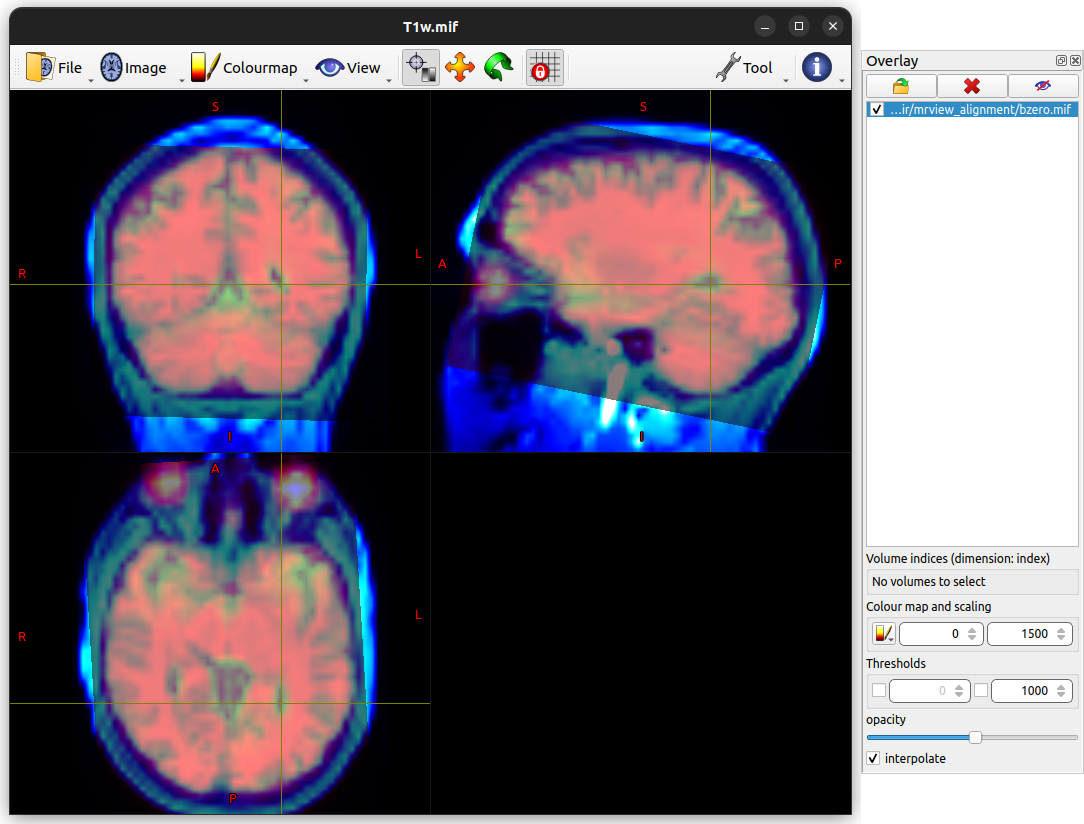 MRView using the Overlay tool to assess image alignment