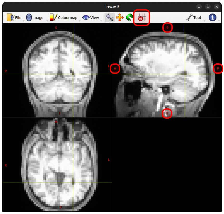 MRView with Lock To Image Axes Off and no interpolation