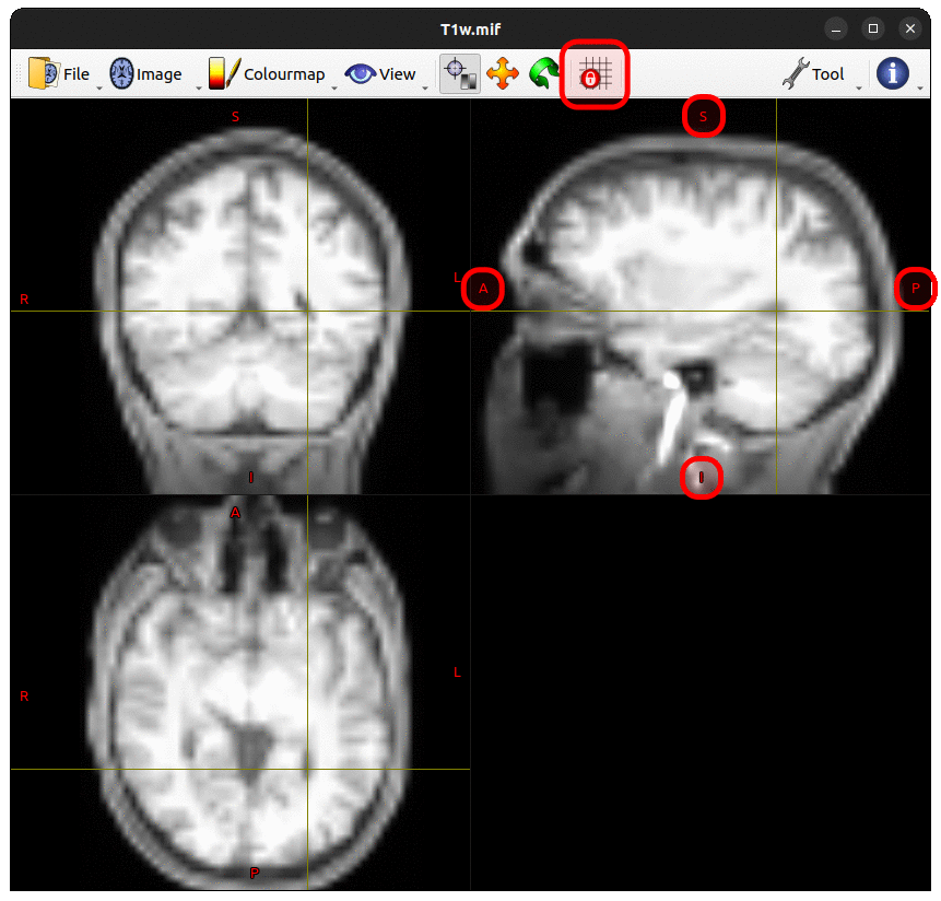 MRView with Lock To Image Axes Off and with interpolation